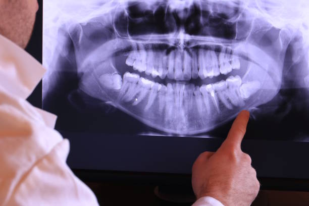 Best Same-Day Emergency Dental Services in Mcmechen, WV
