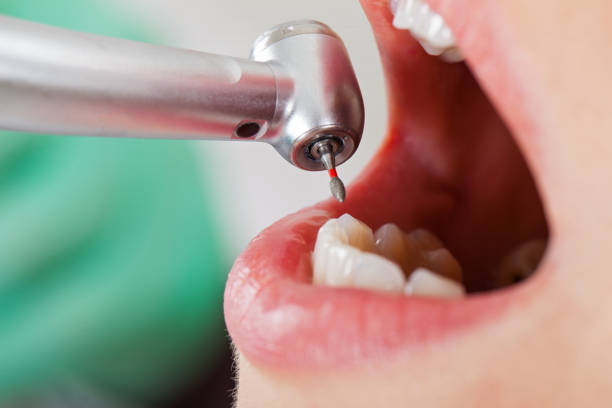 Best Weekend Emergency Dentist in Mcmechen, WV